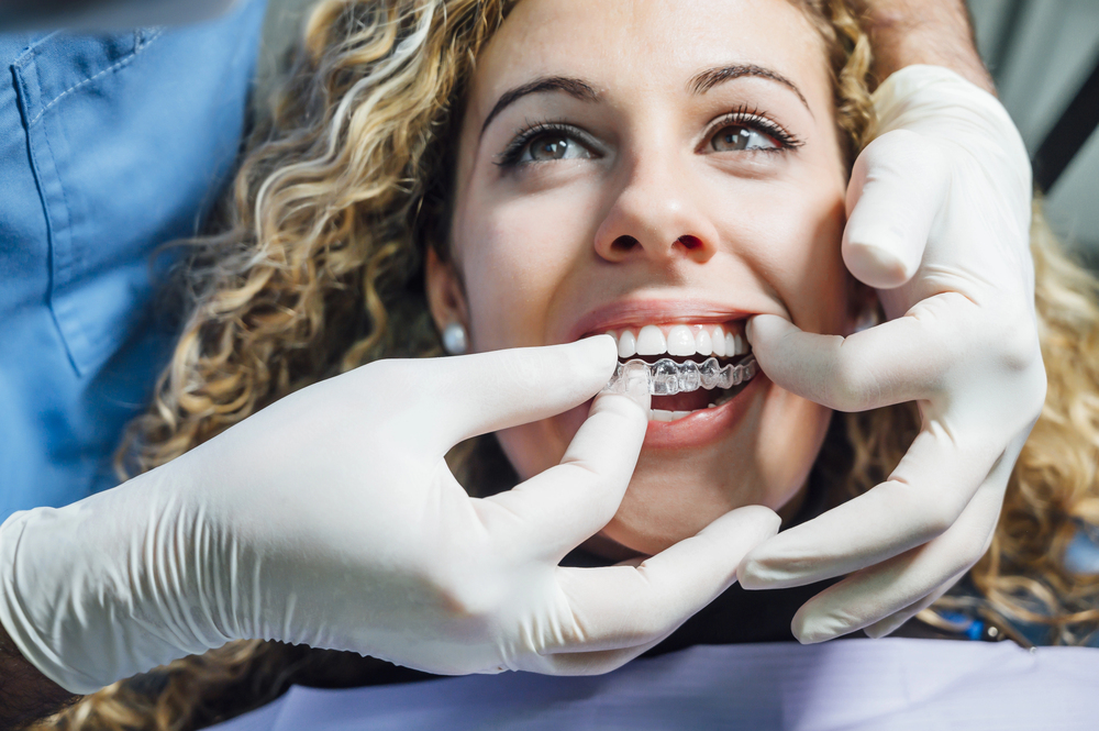 Invisalign and Self-Care: A Lifestyle Upgrade