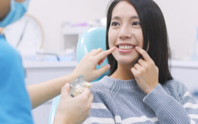The Longevity of Full Arch Dental Implants