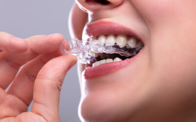 The Art of a Better Smile: How Invisalign Is Redefining Modern Oral Care in Australia
